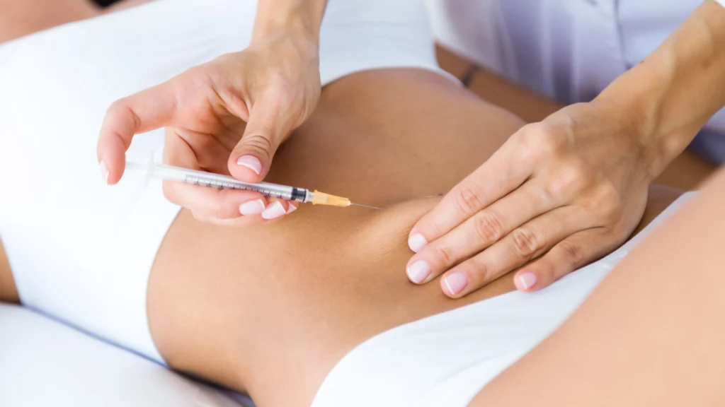 Consultation and treatment area marking are important steps in the process of lipolysis. 